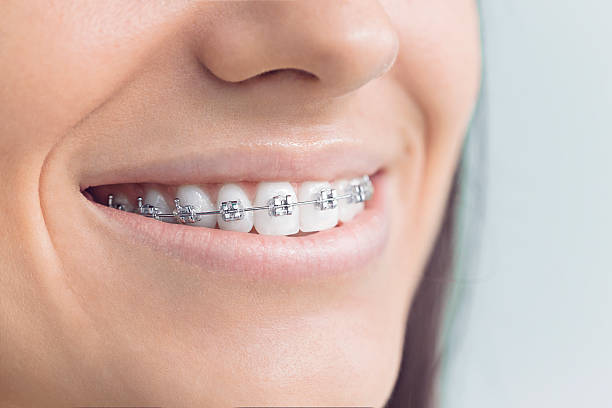 Best Teeth Whitening  in Legend Lake, WI